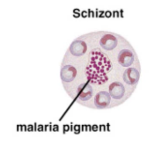 <p>Plasmodium malaria: Schizont</p>