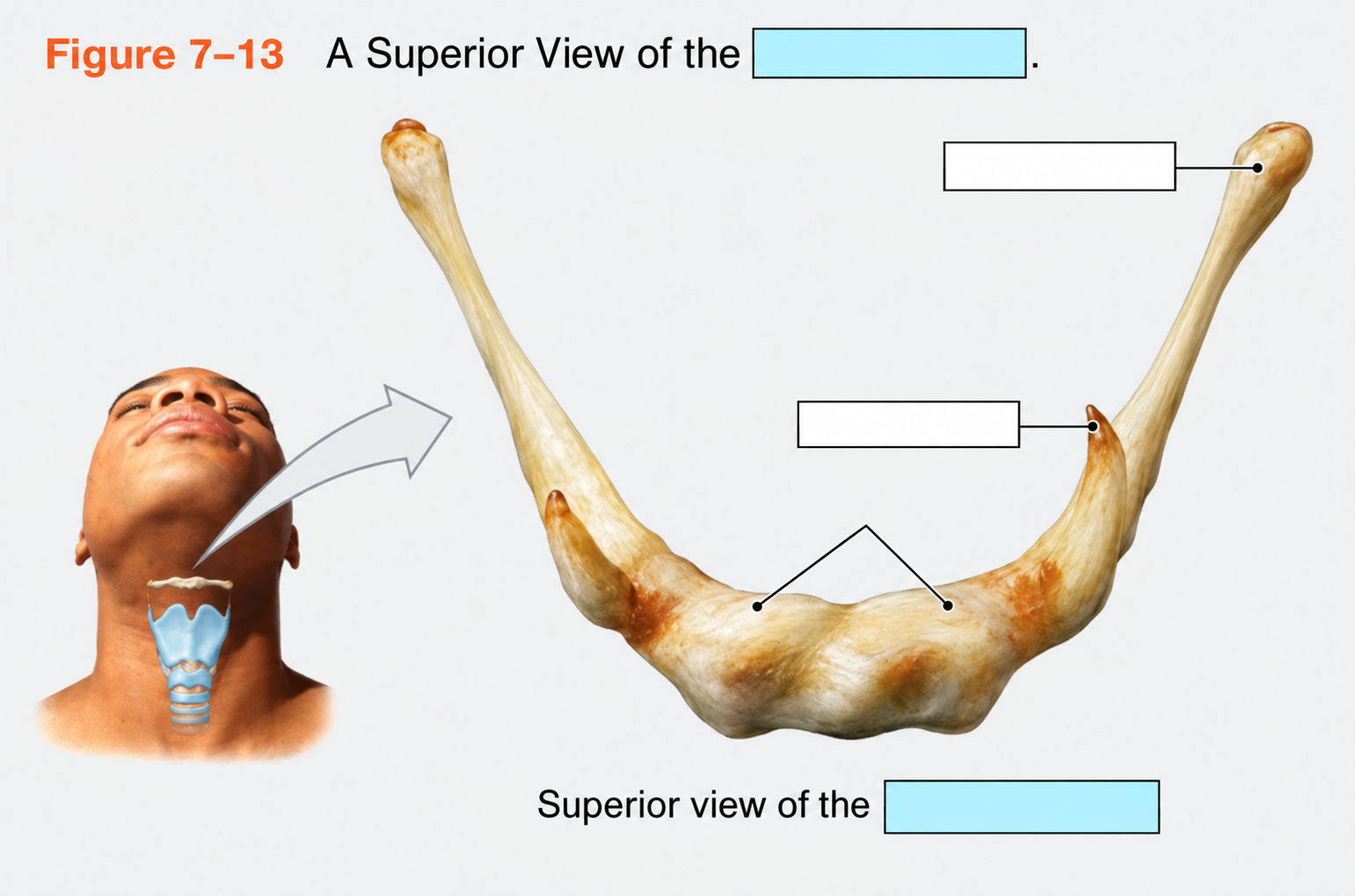 <p>What bone is this?</p>