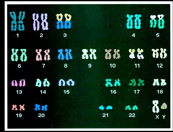<p>A pictorial depiction of an organisms chromosome complement is called a ______. It involves photographing chromosomes during mitosis then lining them up for examination. </p>
