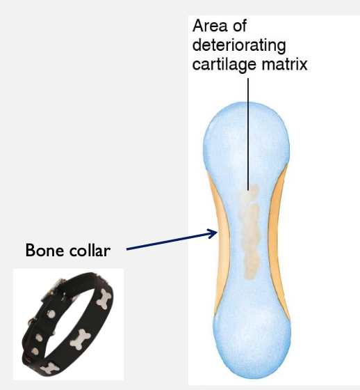 <ul><li><p>Osteoprogenitor cells (precursor to osteoblasts) form in the diaphysis &amp; turn into osteoblasts</p></li><li><p>These osteoblasts deposit a thin layer of bone on the outside of the cartilage. This is called the <strong><u>bone collar</u></strong></p></li><li><p>Chondrocytes inside diaphysis get bigger (hypertrophy) </p></li><li><p>Big chondrocytes release alkaline phosphatase to calcify cartilage in the bone</p></li><li><p>Chondrocytes die </p></li></ul><p></p>