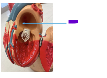 <p>What is the purple arrow?</p>