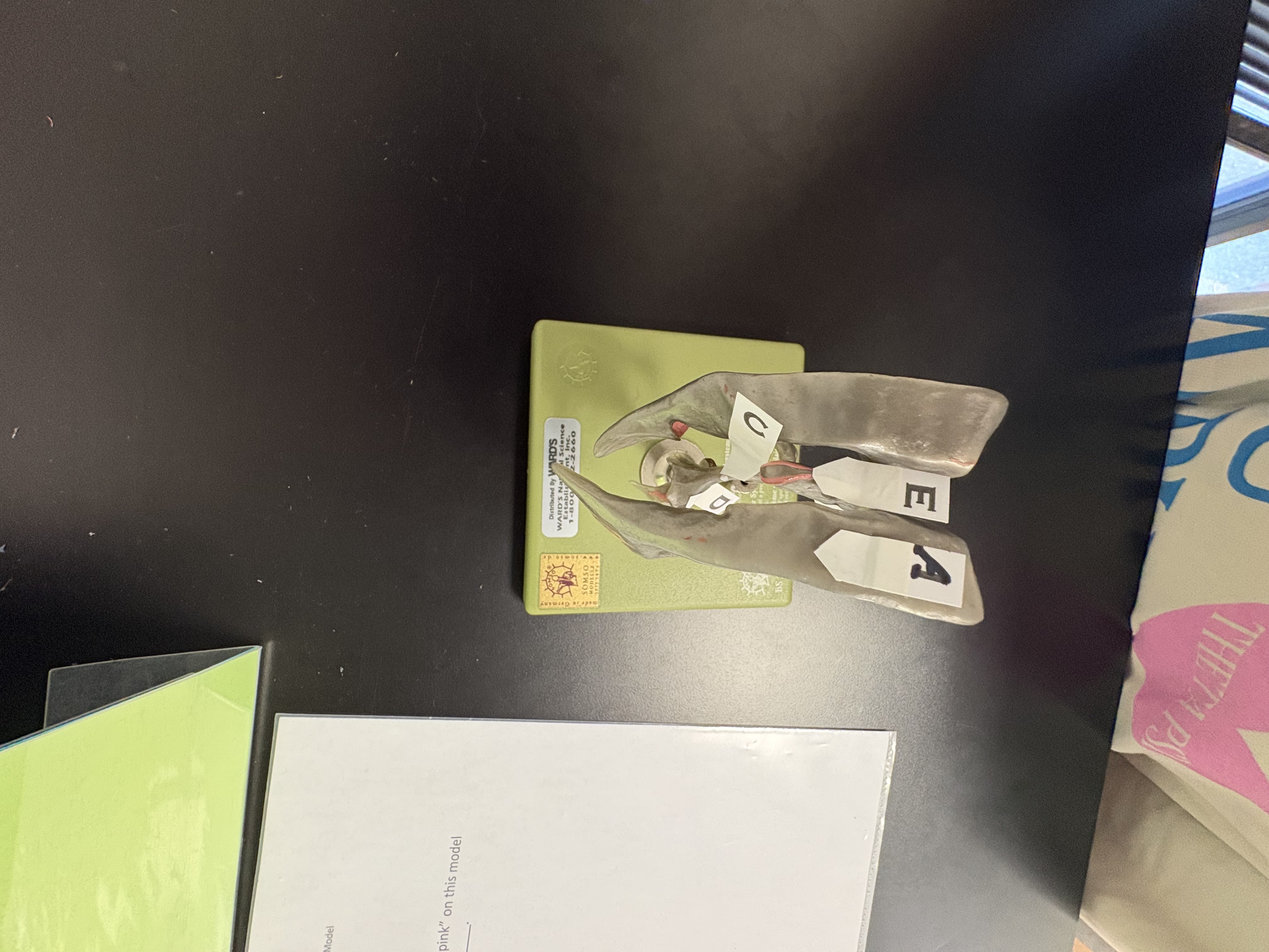 <p>B. identify this cavity</p>