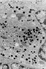 <p>vesicle-like secretions</p><p>dense secretory granules, well-developed Golgi apparatus, and mitochondria with plate-like cristae</p>
