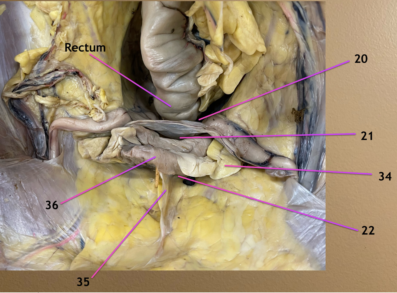 <p>looking into pelvic cavity, cranial to cd view</p><p>.</p><p>label 34, 35</p>