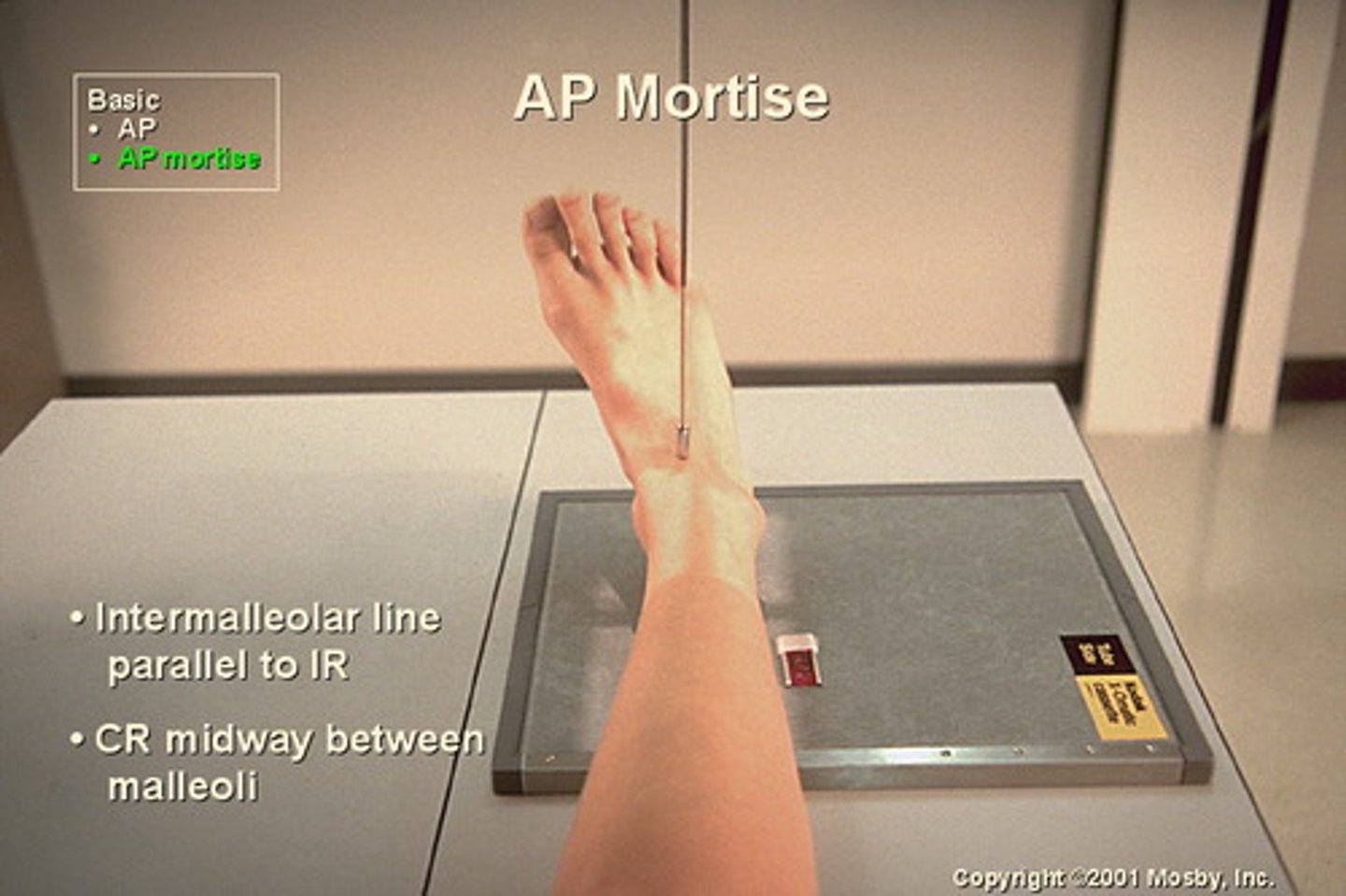 <p>S - on lap</p><p>T - 5 mAs @ 60 kVp</p><p>A - none</p><p>M - correct foot, on cassette</p><p>P - 15-20 degree rotation medially, CR between malleoli</p><p>S - 40"</p><p>B - hold</p><p>C -10 x 12, C</p>