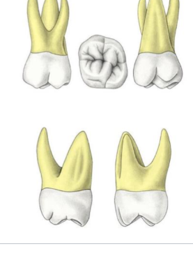 <p>Which tooth?</p>