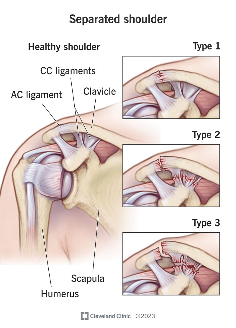 <p>What injury / condition? </p>