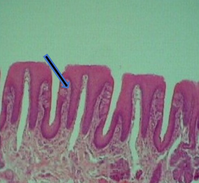 knowt flashcard image