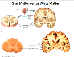 <p>-White matter is myelinated axons and Glia</p><p>Gray matter is the cell bodies, dendrites, axons and glia</p>