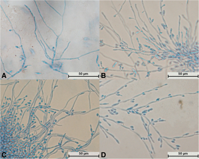 <p>involved in localized and disseminated disease, including of the kidney, lung, skin, eye, heart, and other tissue types</p>