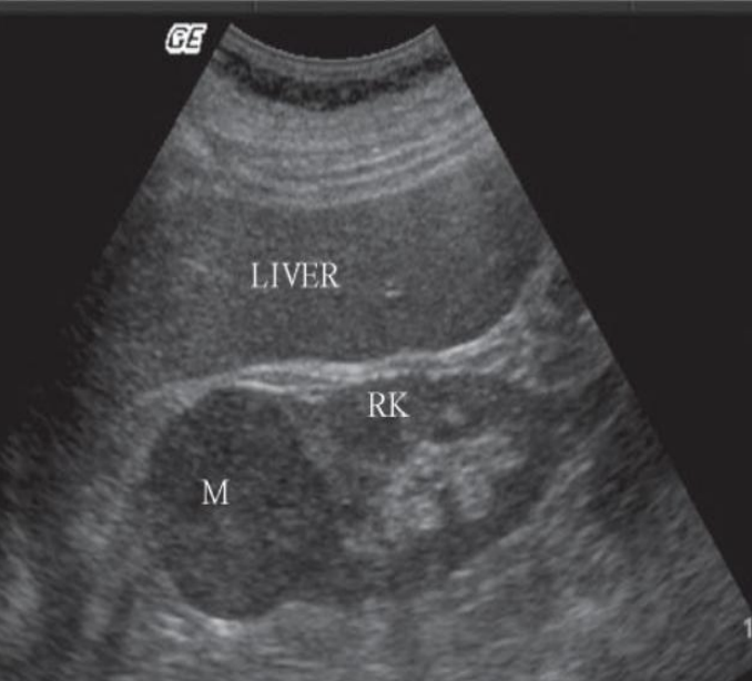 <p>how would you describe this finding? </p>