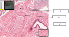 <p>What is the structure at 2</p>
