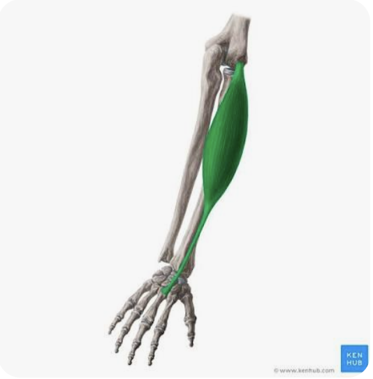<p>O: Lateral epicondyle of the humerus</p><p>I: Dorsal base of the third metacarpal</p><p>A: Extension of the hand at the wrist; abduction/radial deviation of the hand</p><p>N: Radial nerve</p>