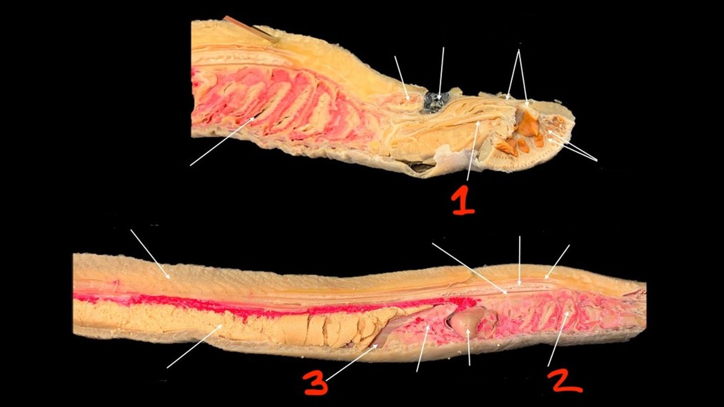 <p>what is 3?</p>
