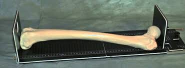 <p>A specialized tool used to measure the linear dimensions of a long bone accurately. Ex: Tibia </p>