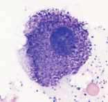 <p>mast cell</p>