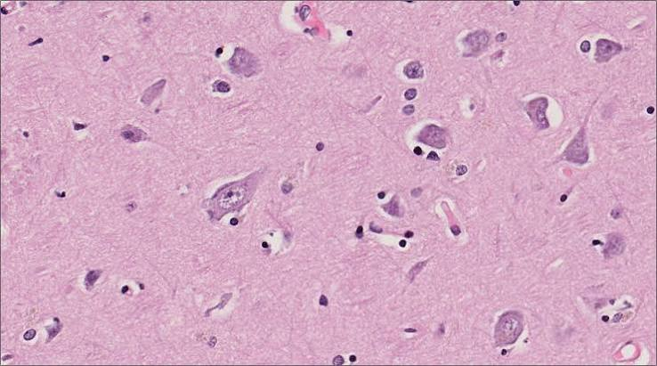 <p>cerebrum </p>
