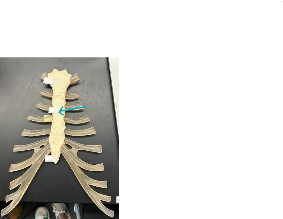 <p>ID sternum/ribs region </p>