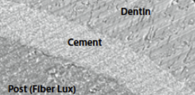 <p>What is monoblock?</p>