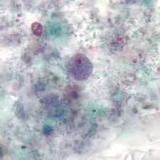 <p>6-12 um, single nucleus</p><p>Irregular “blot-like” karyosome</p><p>Cytoplasma granular &amp; may be vacuolated</p>