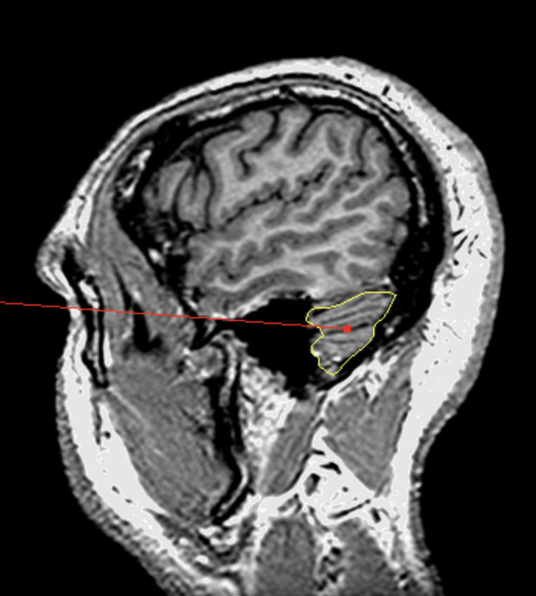 <p>What is the area highlighted called?</p>