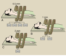 <p>slice thicknesses</p>
