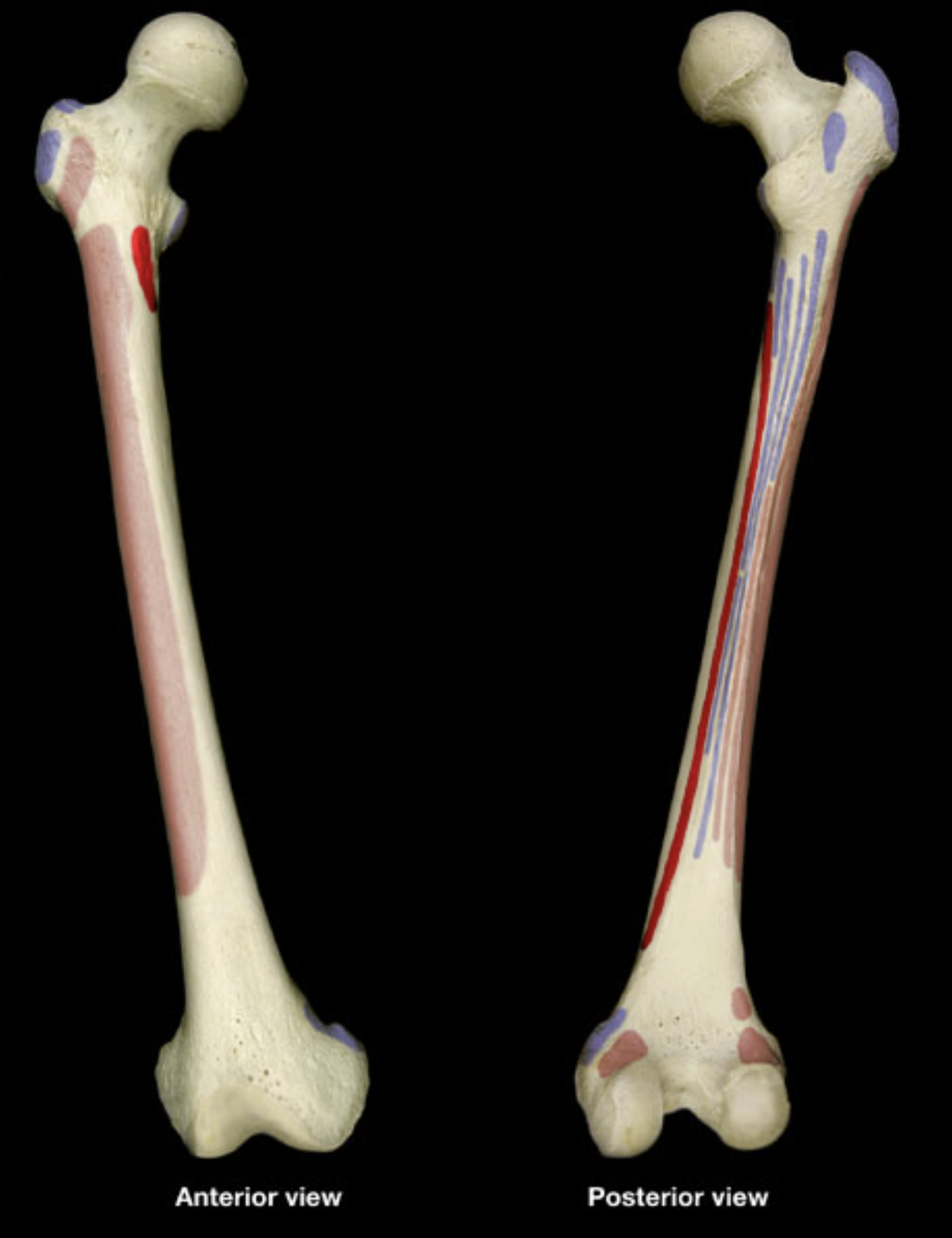 <p>medial side of intertrochanteric line</p><p>linea aspera</p>