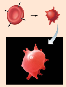<p>Cells lose water by osmosis and</p><p>shrink in a hypertonic solution</p><p>(contains a higher concentration</p><p>of nonpenetrating solutes than</p><p>are present inside the cells).</p>