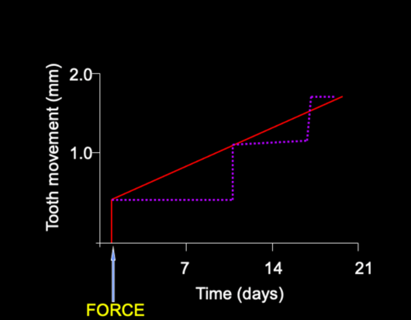 <p>Which line represents light forces on tooth movement?</p>