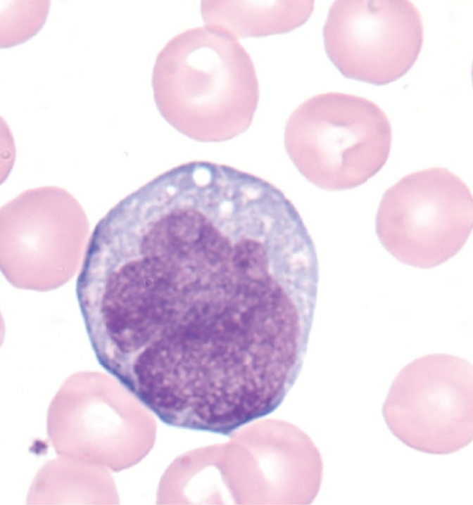 <p>What WBC precursor is this?</p>