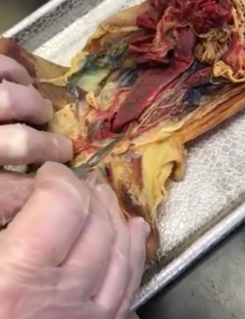 <p>what is the “string” structure prong is touching (2 of them)</p>