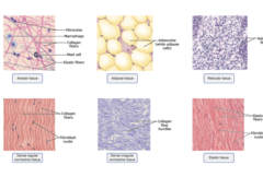 <p>Loose, fibrous, cartilage, bone, blood, adipose</p>