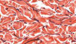 <p>dense irregular connective tissue</p>