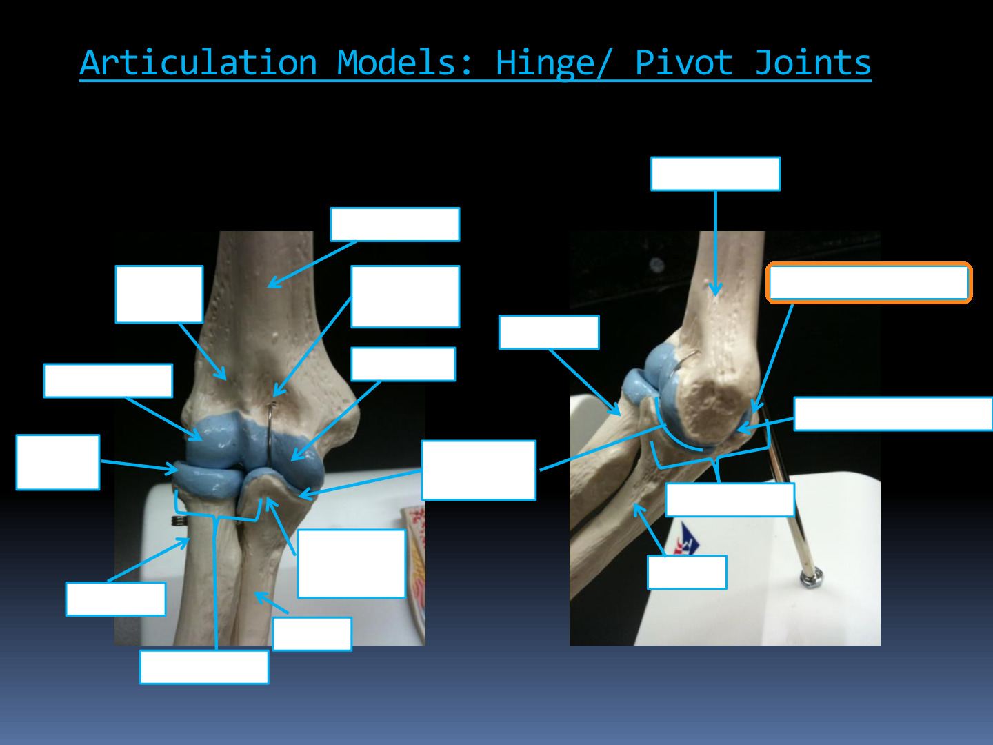 <p>Identify the highlighted structure in the Elbow Articulation Models diagram.</p>