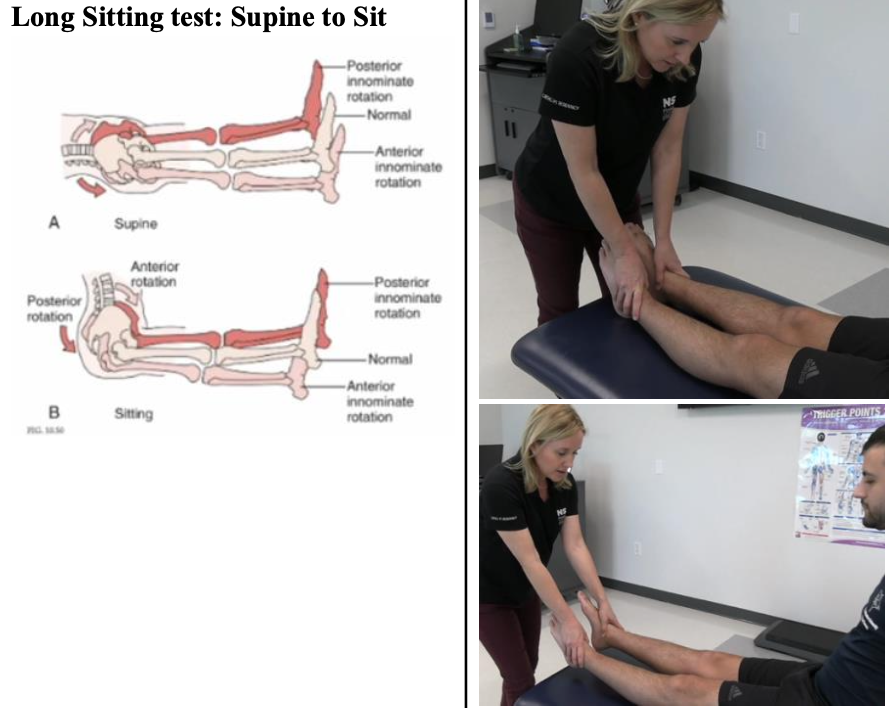 <p><strong>Purpose: </strong>Assess functional leg length change/innominate rotation</p><p></p><p><strong>How to Perform:</strong></p><ol><li><p>Patient supine</p></li><li><p>Patient bridges and lowers to reset pelvis</p></li><li><p>Passively extend the pt’s legs &amp; give slight pull</p></li><li><p>Assess if one leg is significantly longer than the other (or higher/lower at hips)</p><ol><li><p>Compare landmarks: medial malleoli, knees, hips (ASIS)</p></li></ol></li><li><p>Assist patient into long sitting without moving legs</p></li><li><p>Give gentle pull on the legs &amp; look for changes</p></li></ol><p></p><p><strong>Positive Test:</strong> Leg length changes from supine to sitting</p><p></p><p><strong>Interpretation:</strong></p><ul><li><p>Long in supine → anterior innominate rotation</p></li><li><p>Short in supine that becomes long in sitting → posterior innominate rotation</p></li><li><p>Low reliability</p></li></ul><p></p>