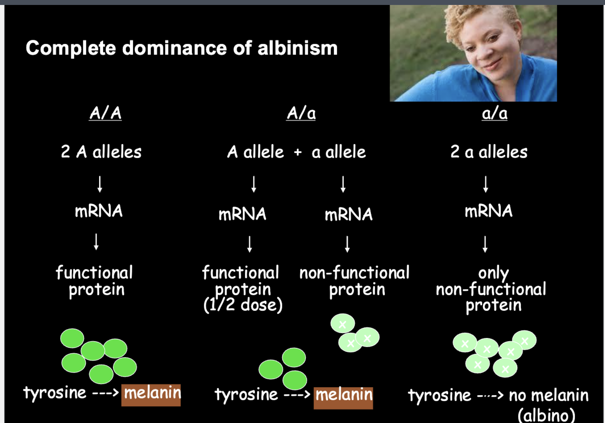 <p>albinism is an example of COMPLETE dominance </p>