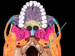 <p>Name this structure.</p>