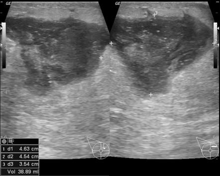 <p>What is this image demonstrating?</p>