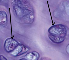 <p>Which part of the hyaline cartilage ECM is the arrow pointing to (darkest staining)?</p>