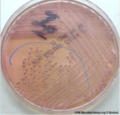 <p>Nosocomial infections related to endotracheal tubes and trachiostomies, also causes peritonitis. Light lavender pink colonies growing on MacKonk agar, negative oxidase</p>