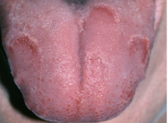 <p>ID the pathology:</p>