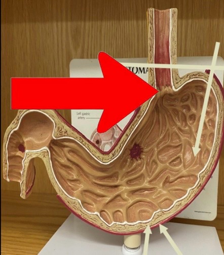 term image