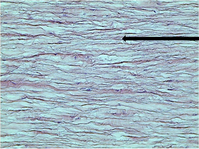 <p>what tissue is this? </p>