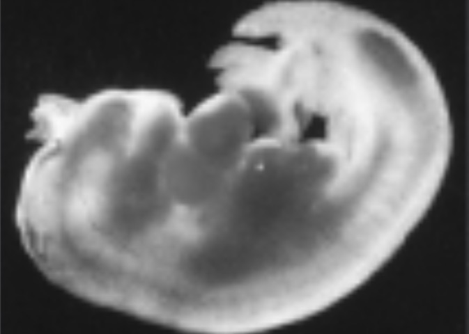<p>1 mês</p>