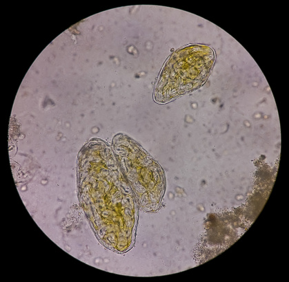 <p>Parasite or Artifact? Identify.</p>