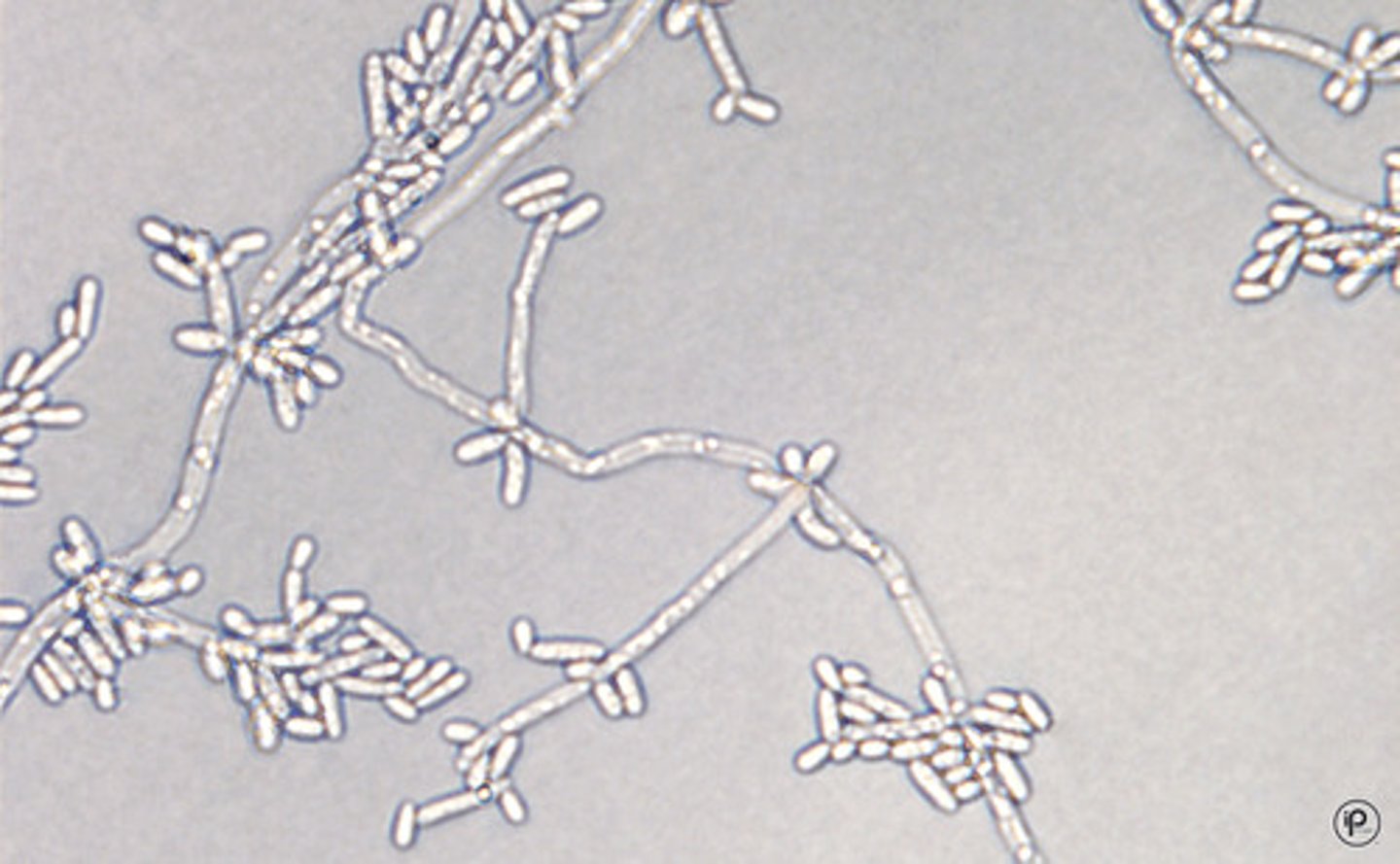 <p>Crossed matchsticks, tree-like</p><p>Long branching pseudohyphae</p><p>Elongate blastoconidia form chains at junctions</p>