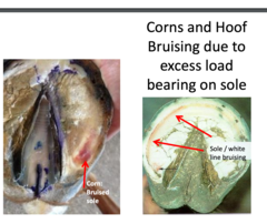 <p>resection of bruised tissue, soft bedding with poultice until soleis firm, then apply wide webbed seated out shoe with no sole pressure</p>