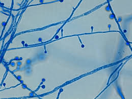 <p>Broad based ābulbsā budding yeasts</p>