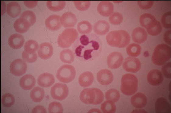 <p>This smear is considered?</p>