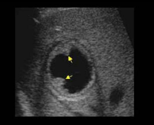 <p>Identify this image.</p>